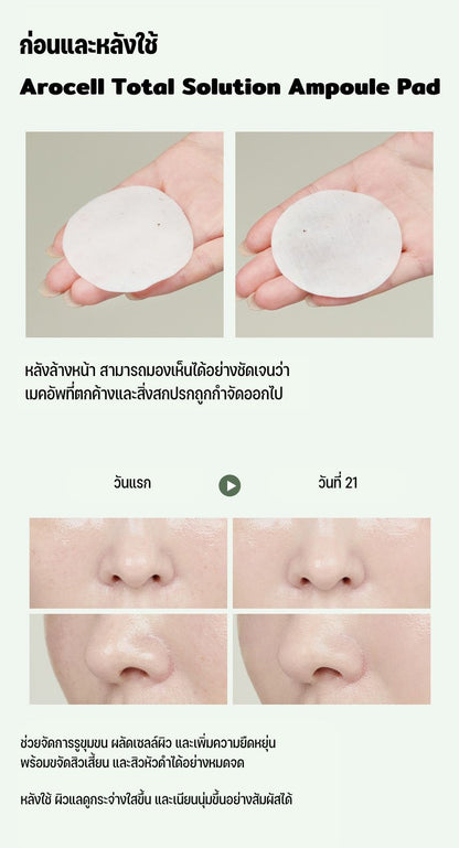 Total Solution Ampoule Pads 28ea 